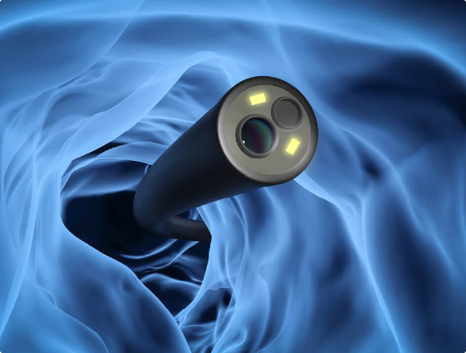 纖維支氣管鏡與電子支氣管鏡：哪個更適合您的醫療需求？鼴鼠醫療替您解答