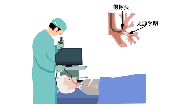 電子支氣管鏡可以應用在臨床哪些科室呢.png 電子支氣管鏡可以應用在臨床哪些科室呢.png