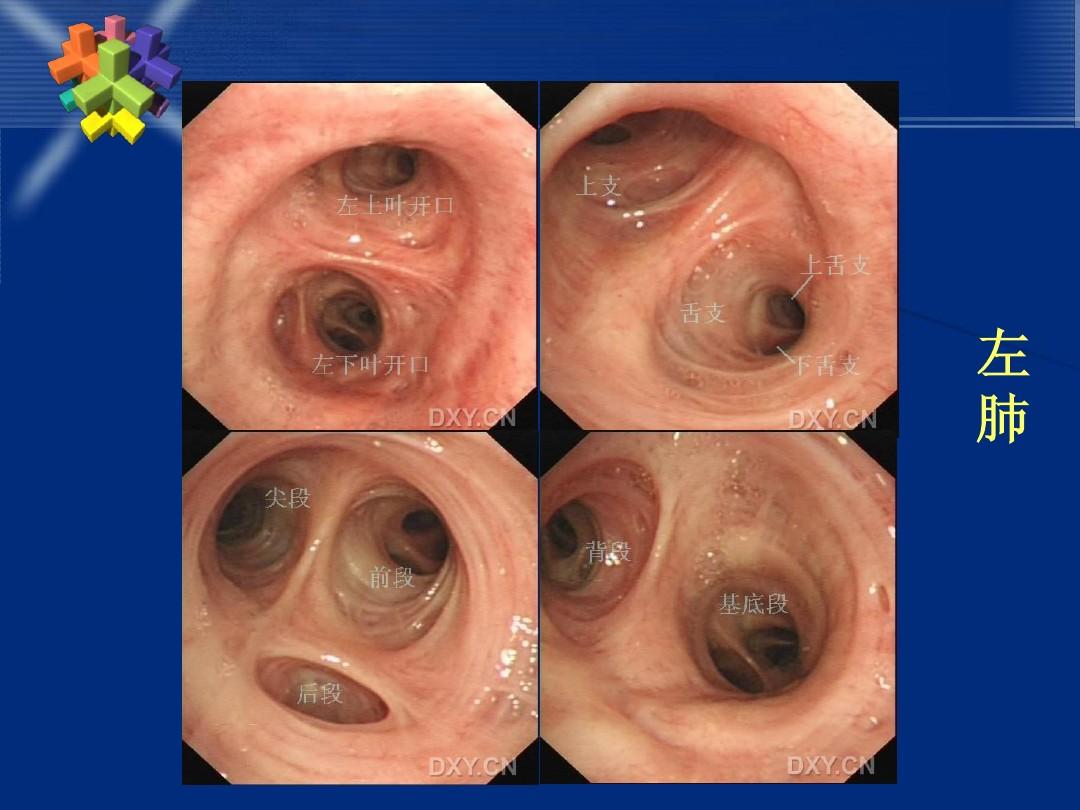 電子支氣管鏡可以應用在臨床哪些科室呢.jpg 電子支氣管鏡可以應用在臨床哪些科室呢.jpg